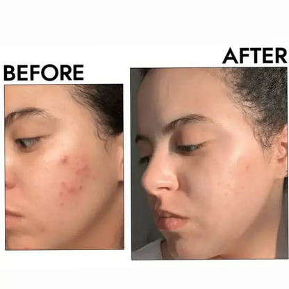 Dr. Althea 345 Relief Cream(50 ML)- 100% Original