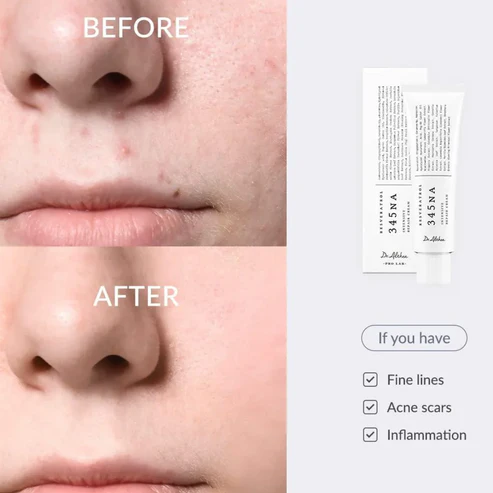 Dr. Althea 345 Relief Cream(50 ML)- 100% Original